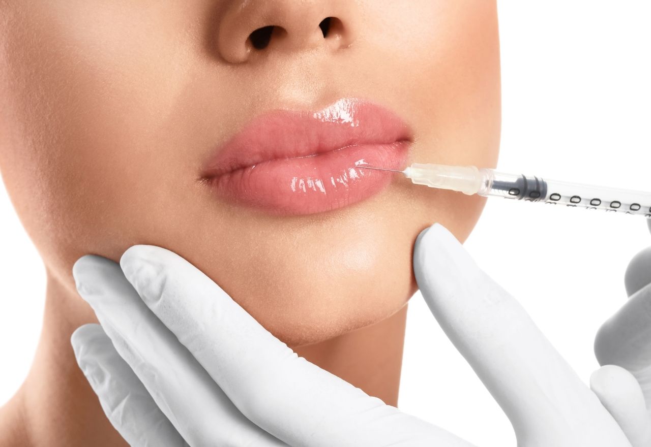 Lip Fillers: Aesthetic Touch and Detailed Information on Longevity