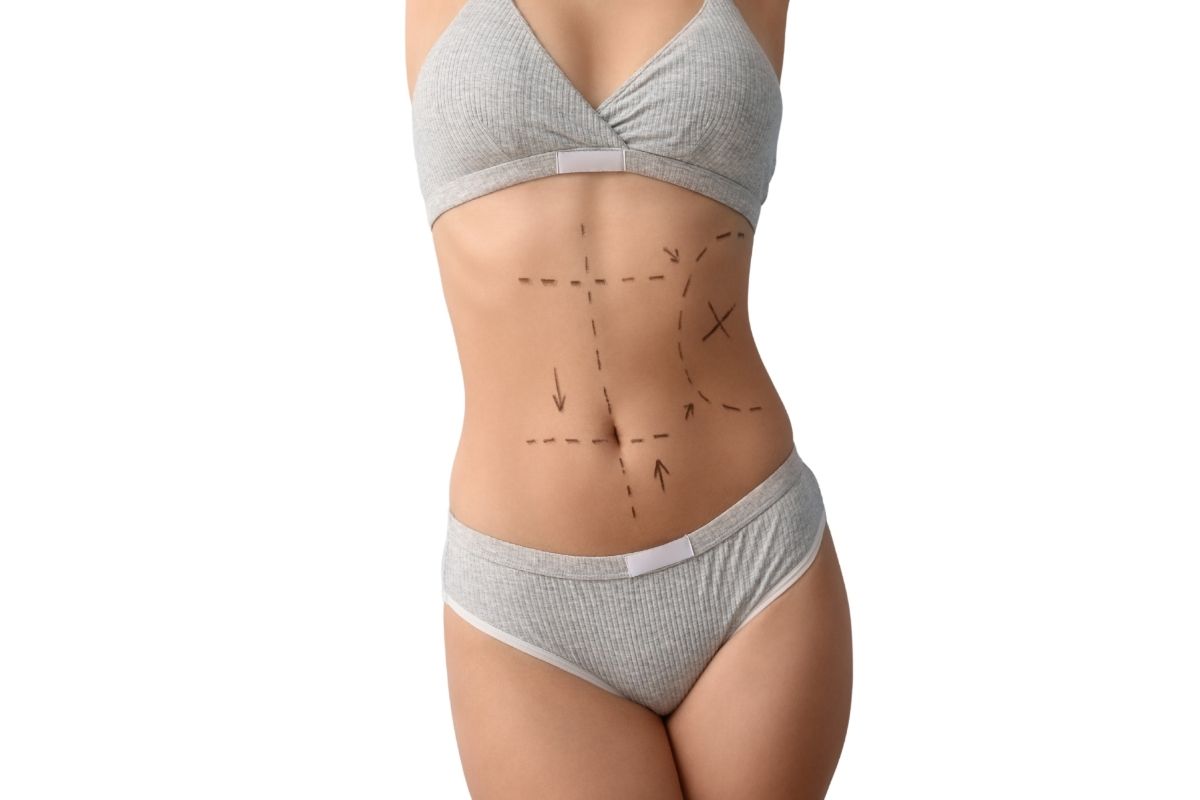 Cultural and Social Views Covering Aesthetic Surgery