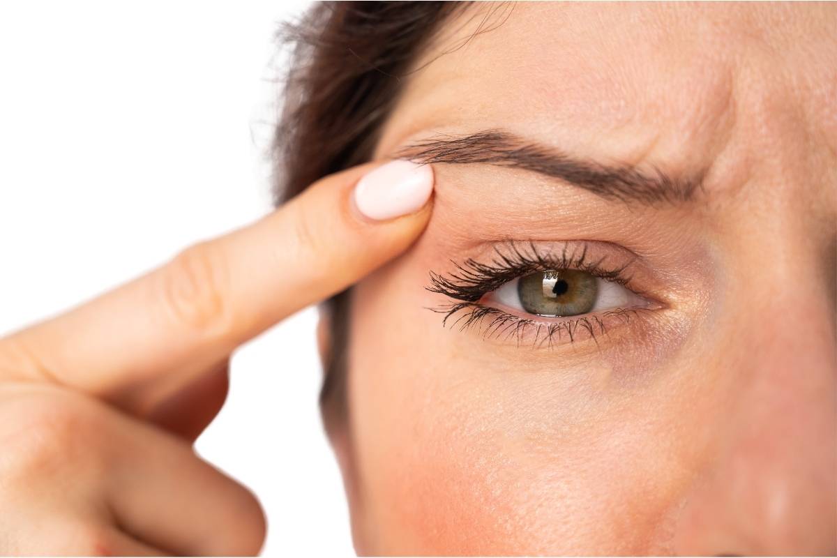 Scars After Eyelid Surgery: A Natural Healing Process