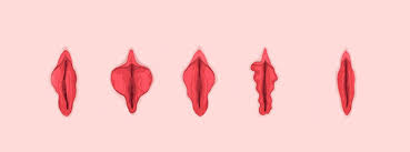 Labiaplasty: Aesthetic and Reconstructive Surgery for the Labia Minora or Majora