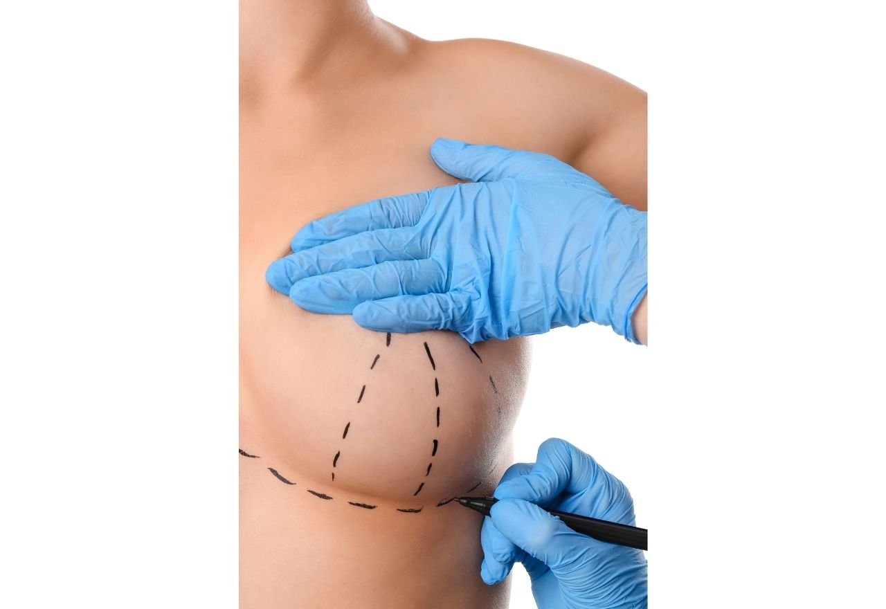 Breast Aesthetics (mammoplasty): Postoperative Process and Frequently Asked Questions