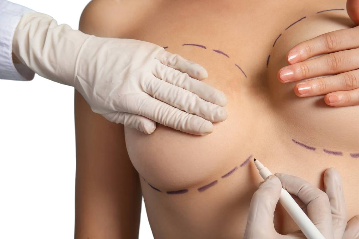 Does Breast Reduction Surgery Reduce Back Pain?