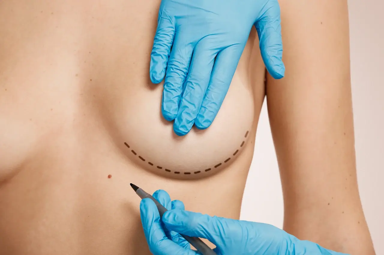 Breastfeeding after Breast Reduction Surgery: What You Need to Know