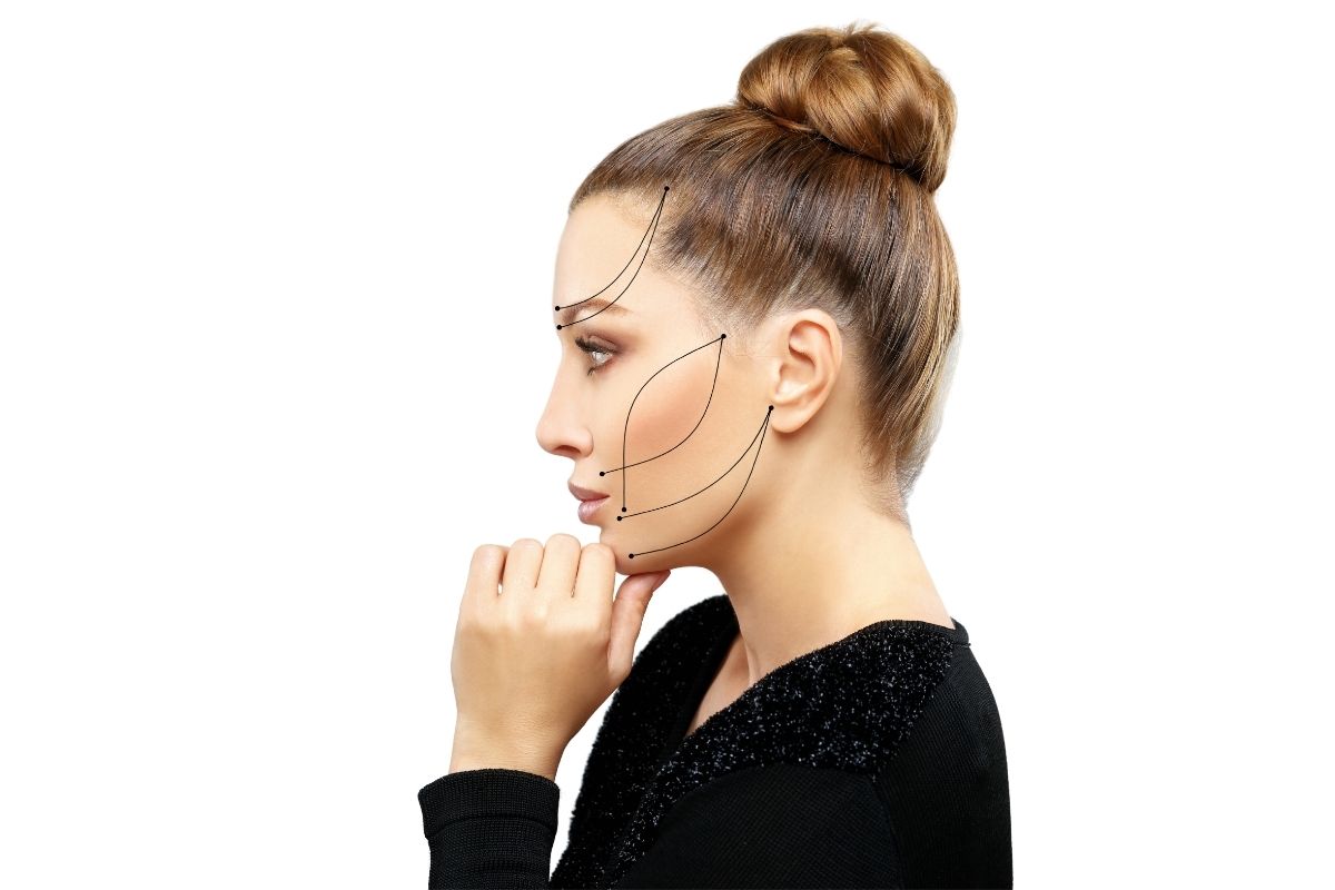 Are There Any Scars After Facelift Surgery? 